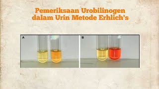 PEMERIKSAAN UROBILINOGEN URINE METODE ERHLICHS [upl. by Atnicaj951]