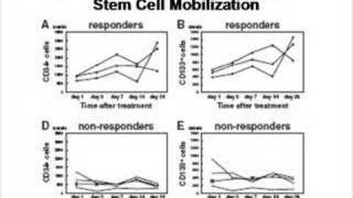 Stem Cell Therapy for Critical Limb Ischemia [upl. by Sesiom]