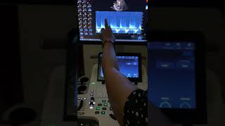 video 5 EchocardiographyHearts ultrasound2D [upl. by Georgette]