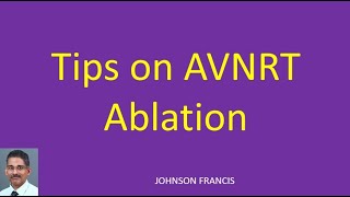 Tips on AVNRT Ablation [upl. by Garin]