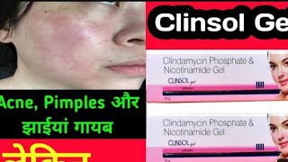 Clinsol gel review  Clinsol gel  Best pimple gel  पिंपल्स के लिए सबसे बेस्ट जेल  क्लिंसोल जेल [upl. by Mariana]