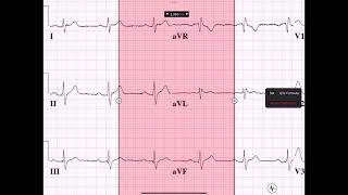 PWAVE PRI MEASUREMENTS [upl. by Xenos]