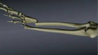 Reducing a Distal Radius Fracture [upl. by Ehcsrop961]