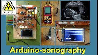 ultrasonic body sonography with arduino  part 2 [upl. by Elorac670]