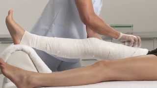 Plaster of Paris Knee Circular Cast Application [upl. by Tala]