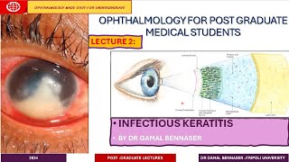 Infectious Keratitis STATE OF THE ART DIAGNOSIS AND MANAGMENT LECTURE 2 Bacterial KERATITIS [upl. by Atirec]