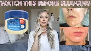 What Is Skincare Slugging How to Slug Skin  How to Repair Skin Barrier Damage Vaseline on Face [upl. by Fadden]