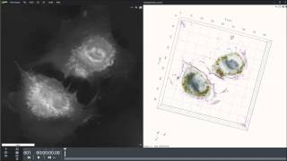 HUVEC cells with gold nanoparticles [upl. by Ettereve]