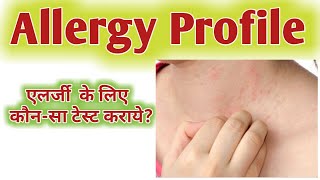 Allergy blood test name hindi  Allergy test report  Allergy blood test [upl. by Loredo]