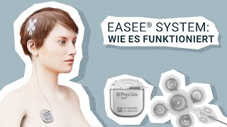 So funktioniert das EASEE® System  EASEE®INSIGHTS [upl. by Meeks]