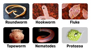 9 Warning Signs of Parasites [upl. by Ludwig]