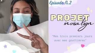 Projet INVISALIGN  Ep2  trois jours avec moi durant ma pose de gouttière [upl. by Howlyn508]