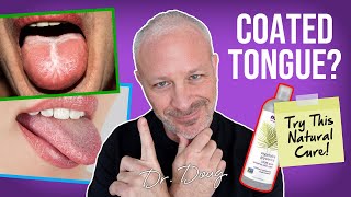 COATED TONGUE Glycerin Remedy  Dr Doug Willen [upl. by Kirstin]