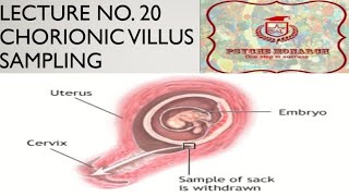 chorionic villus sampling in urdu [upl. by Tunnell138]