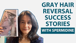 Gray Hair Reversal Success Stories with Spermidine [upl. by Cirenoj]