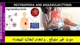 Lecture 23 Neutropenia and Agranulocytosis [upl. by Nosrak]