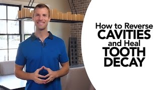 How to Treat Cavities and Reverse Tooth Decay Naturally [upl. by Drawde5]