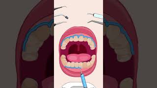 ASMR dental care asmr animation asmranimation funny cartoon [upl. by Michaud]