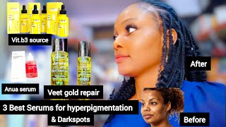 BEST FACE SERUMS FOR A GLOWING SKIN HOW TO CLEAR HYPERPIGMENTATION QUICKLY  FACE amp BODY TREATMENT [upl. by Rasla82]