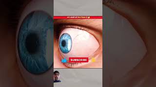 Blind man blindman factsinhindi amazingfacts knowledge eyes blindsapvlogs666 greenscreen [upl. by Yllim]