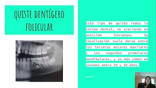 lesiones periapicales [upl. by Nigem]