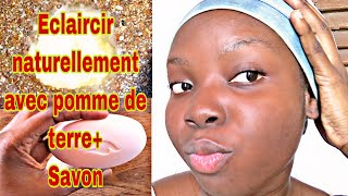 Eclaircir son visage naturellement juste avec la pomme de terre astucepommedeterre astuces [upl. by Atinauj]