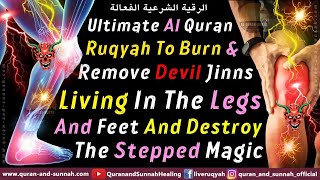 Ruqyah To Burn And Remove Devil Jinns Living In The Legs And Feet And Destroy The Stepped Magic [upl. by Aihtekal246]