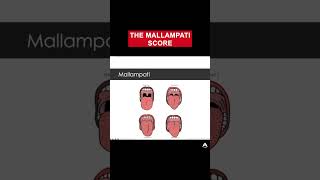 The Mallampati Score  shorts anaesthetics cico [upl. by Ansev]