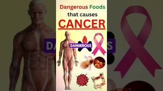 Dangerous foods that causes CANCER [upl. by Sidnac]