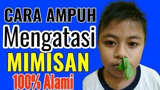 Daun Sirih UNTUK Mengatasi MIMISAN Begini Caranya Sob [upl. by Ritchie]