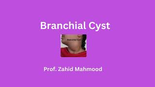 Branchial Cyst by Prof Zahid Mahmood [upl. by Harlamert]