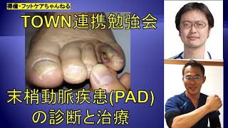 抹消動脈疾患PADの診断と治療 [upl. by Breech517]