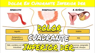 ⚕️🩺 DOLOR EN LADO DERECHO DEL ABDOMEN  Apendicitis o Diverticulitis o Embarazo Ectópico [upl. by Azeria]