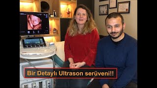 Bir detaylı Ultrason serüveni [upl. by Drus]