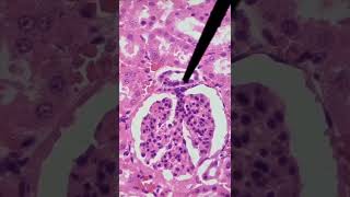 ¡TIPS PARA IDENTIFICAR LA MÁCULA DENSA Y El GLOMÉRULO RENAL en MICROSCOPIOhistología renal riñón [upl. by Atika]