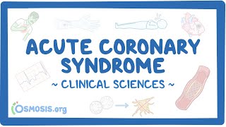 Acute coronary syndrome Clinical sciences [upl. by Eleonore]