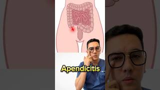 Síntomas de alerta de apendicitis que no debes ignorar  Dr William Guerrero medicina shorts [upl. by Edora456]