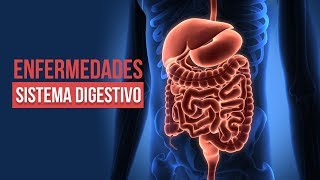 10 ENFERMEDADES DEL SISTEMA DIGESTIVO MÁS COMUNES 😷 ¡CUIDADO CON LA 7 [upl. by Kissee]