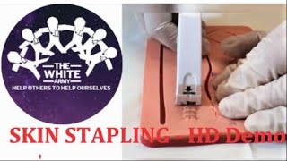 SKIN STAPLING  HD Demonstration [upl. by Airbmac]