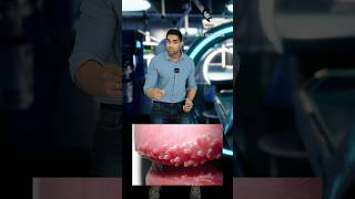 ஆணுறுப்புக்குள் சிறு பருக்களா Pearly penile papules Dr Isacc Abbas [upl. by Davidson]