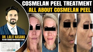 COSMELAN PEEL TREATMENT  ALL ABOUT COSMELAN PEEL  BY DRLALIT KASANA [upl. by Katrina310]