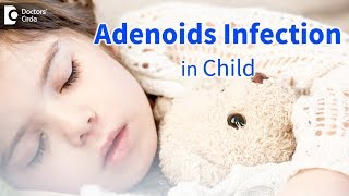 Infected adenoids in children Signs Symptoms Diagnosis  Dr Satish Babu K [upl. by Ettenot]