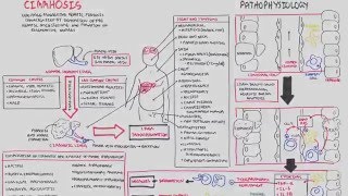 Liver Cirrhosis SandS Pathophysiology Investigations Management [upl. by Feodor515]