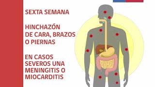 Video 2 Triquinosis síntomas y tratamiento [upl. by Aneba691]