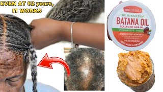 HOW TO USE BATANA OIL FOR HAIR GROWTH I tried it n my hair growth has doubled in one month [upl. by Oratnek]