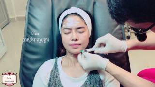 XENO CLINIC PRP Plasma by ny monineath បូមឈាមចាក់មុខឲ្យនៅក្មេងសុវត្ថិភាព 100 [upl. by Nelrac]