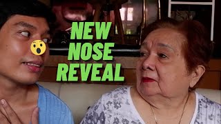 Rhinoplasty Vlog Pt 2  The Reveal  Alol Reacts to Paos New Nose  Cebu Philippines  Alol amp Pao [upl. by Eelarbed]