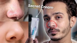 OMG This Cream Erases Blackheads amp Whiteheads Like Magic 😱 [upl. by Neffirg]