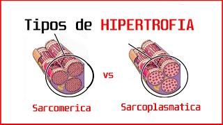 👉🏽💪🏻Tipos de HIPERTROFIA MUSCULAR SARCOMERICA y SARCOPLASMATICA  AGUDA Y CRONICA [upl. by Yniar]