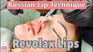 Revolax Lips  Russian Lip Technique  Revolax Deep 11 ml [upl. by Belak]